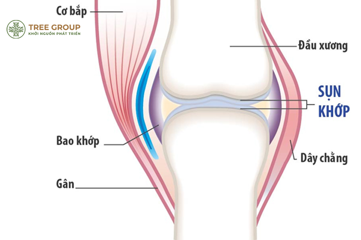 Nguyên nhân và cách khắc phục chứng đau nhức đầu gối hiệu quả tại nhà